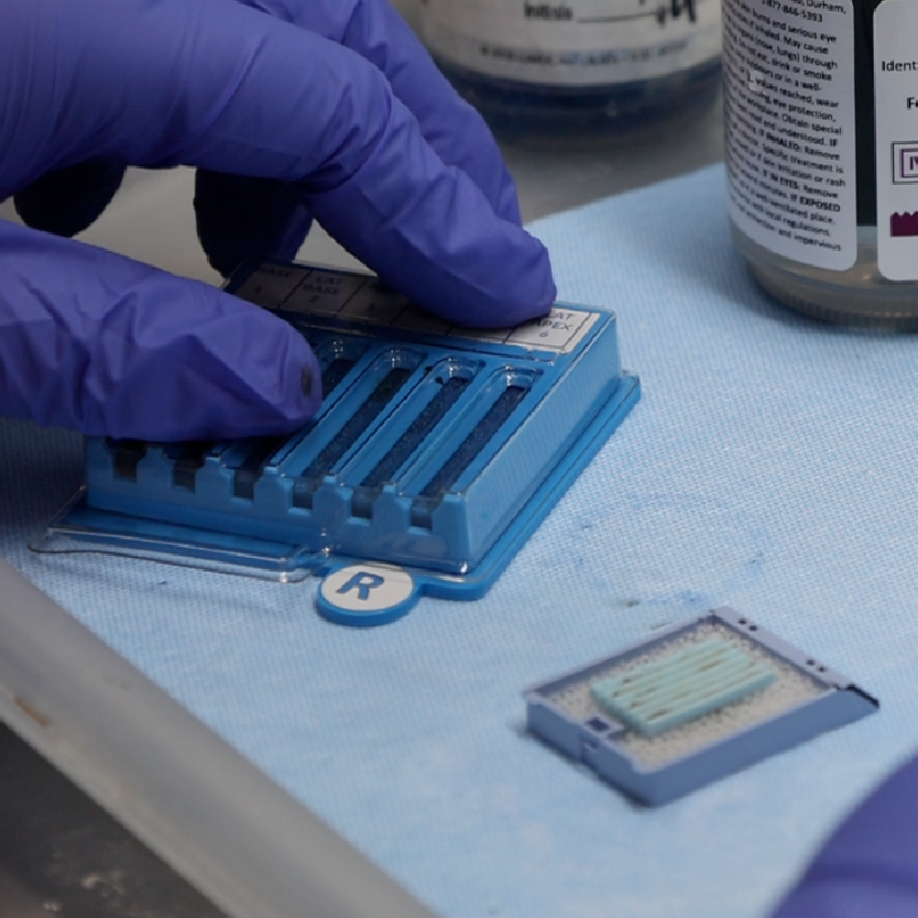 BxBoard® Transrectal Prostate Kit 12-Site