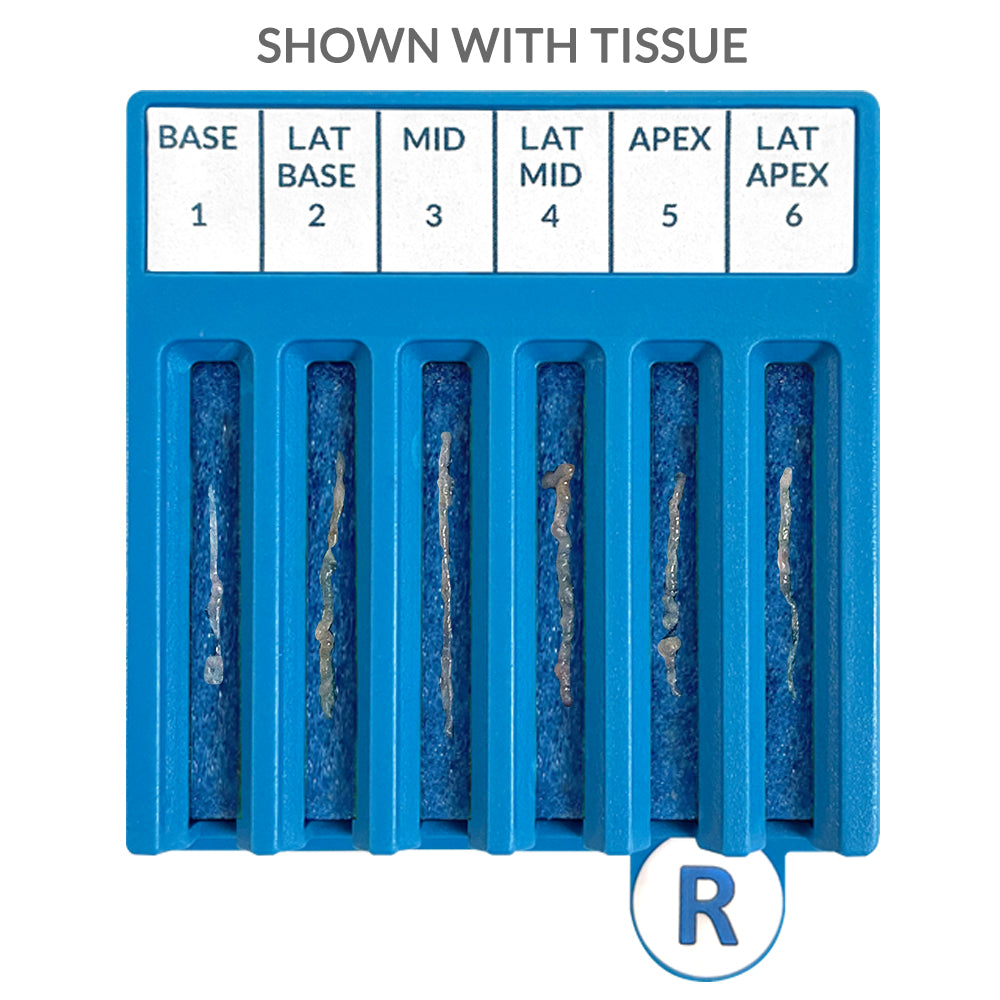 BxBoard® Transrectal Prostate Kit 12-Site