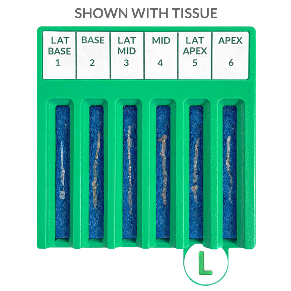 BxBoard® Transrectal Left Board