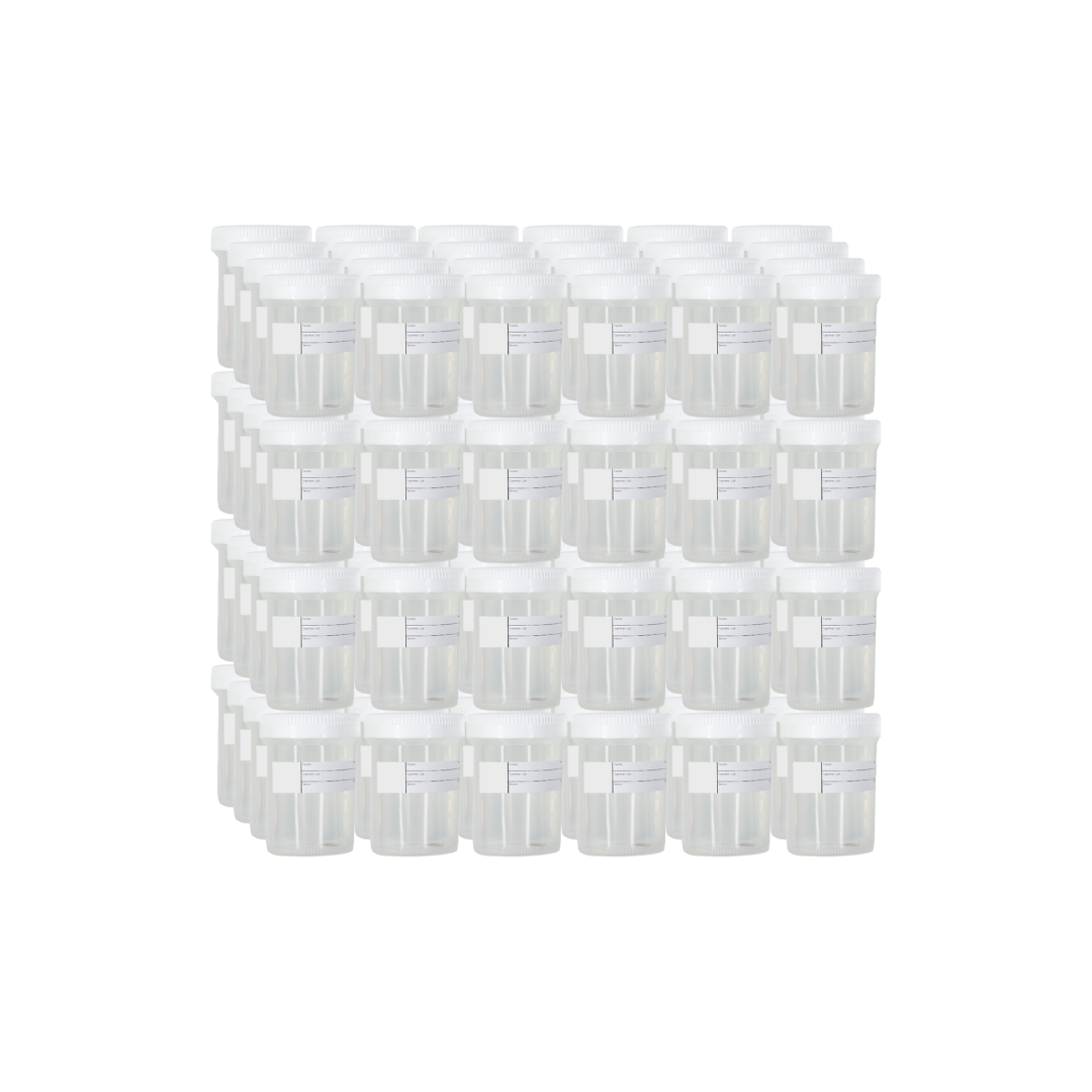 (Non-GYN/Urine) Bulk Cytology Collection Bottles