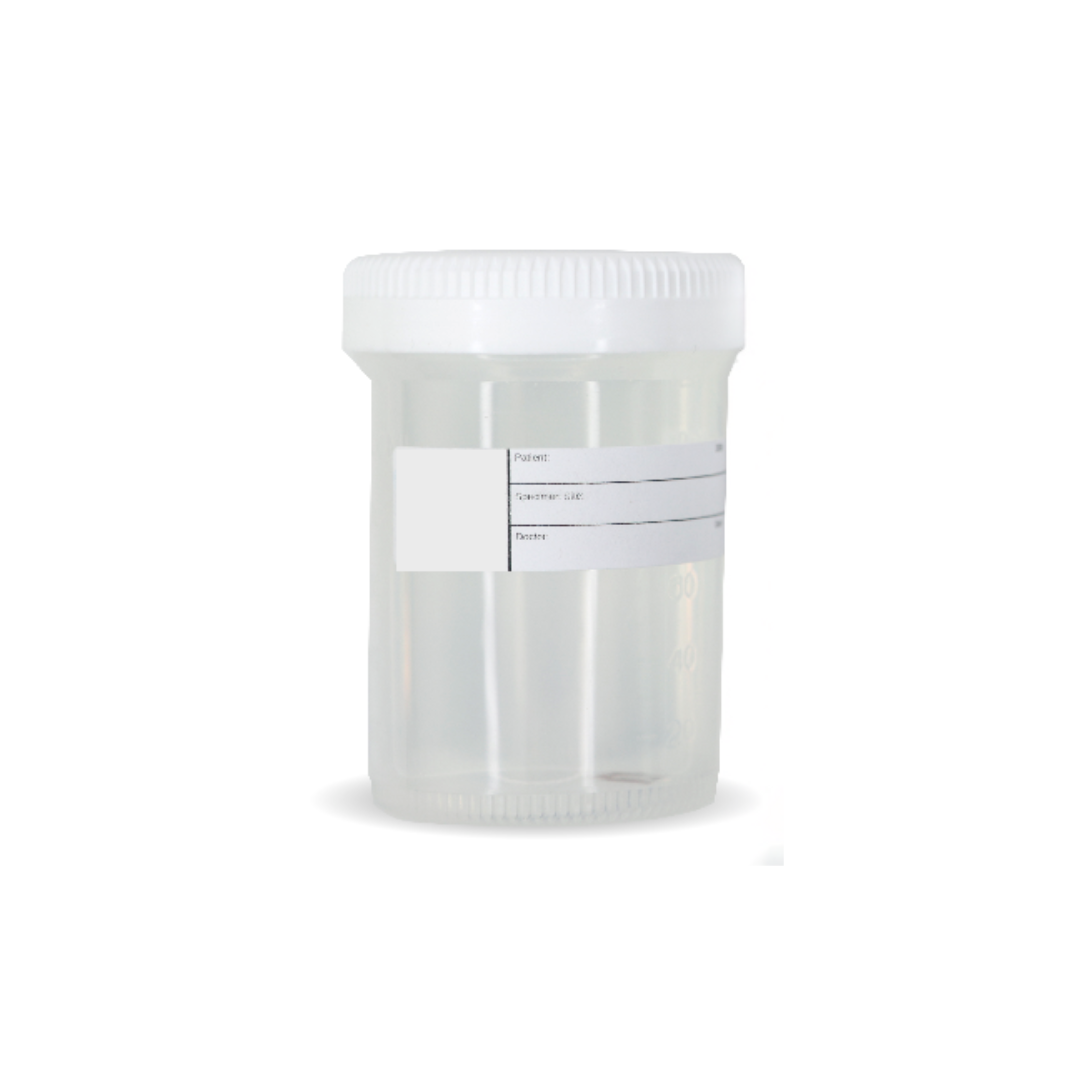 (Non-GYN/Urine) Single Jar Cytology Collection Kit