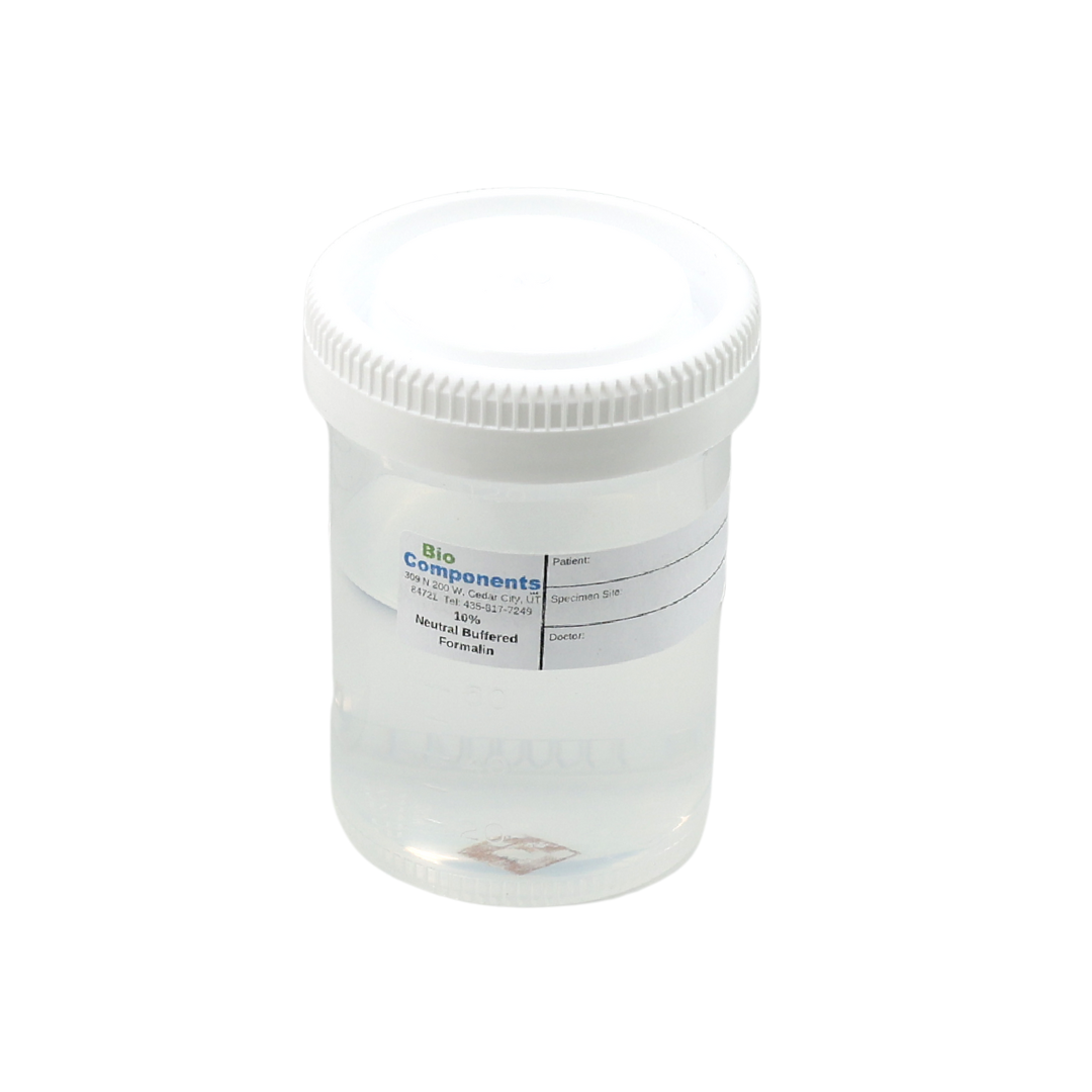 Specimen Container (Prefilled 30mL) 60mL